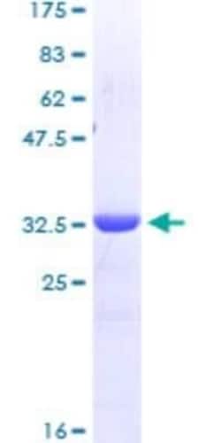 Novus Biologicals Recombinant Human GATA-3 GST (N-Term) Protein 10 &mu;g | Buy Online | Novus Biologicals&trade; | Fisher Scientific