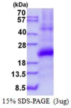 Novus Biologicals&trade;&nbsp;Recombinant Human GILT/IFI30 His Protein