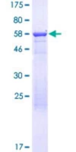 Novus Biologicals Recombinant Human GOLGA6L9 GST (N-Term) Protein 25 &mu;g | Buy Online | Novus Biologicals&trade; | Fisher Scientific