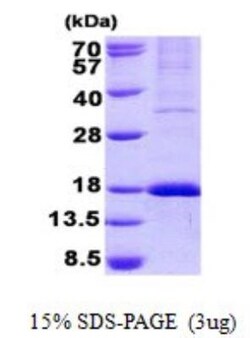 Novus Biologicals&trade;&nbsp;Recombinant Human GPR177/WLS His Protein
