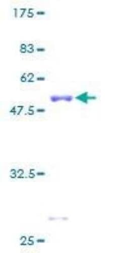 Novus Biologicals Recombinant Human GRB2 GST (N-Term) Protein 10 &mu;g | Buy Online | Novus Biologicals&trade; | Fisher Scientific