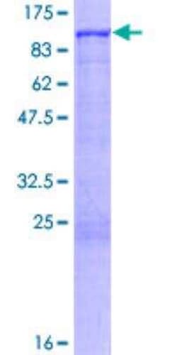 R&D Systems&trade;&nbsp;Recombinant Human GRK2 GST (N-Term) Protein
