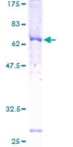 Novus Biologicals Recombinant Human GRK3 GST (N-Term) Protein 10 &mu;g | Buy Online | Novus Biologicals&trade; | Fisher Scientific