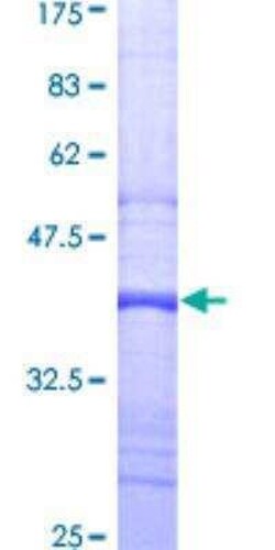 Novus Biologicals Recombinant Human GRK3 GST (N-Term) Protein 10 &mu;g | Buy Online | Novus Biologicals&trade; | Fisher Scientific