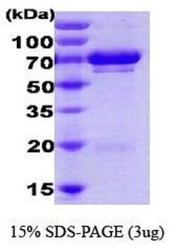 Novus Biologicals Recombinant Human GRP75/HSPA9B/Mortalin His Protein 0,1 mg | Buy Online | Novus Biologicals&trade; | Fisher Scientific