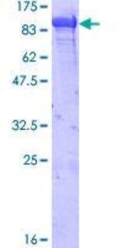 Novus Biologicals Recombinant Human GRP78/HSPA5 GST (N-Term) Protein 10 &mu;g | Buy Online | Novus Biologicals&trade; | Fisher Scientific