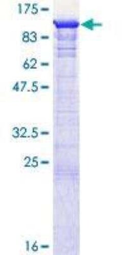 Novus Biologicals Recombinant Human GSPT1 GST (N-Term) Protein 10 &mu;g | Buy Online | Novus Biologicals&trade; | Fisher Scientific