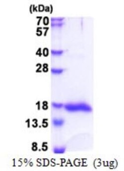 Novus Biologicals&trade;&nbsp;Recombinant Human Galectin 13 His Protein