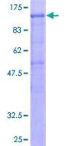 Novus Biologicals Recombinant Human Gemin 3 GST (N-Term) Protein 25 &mu;g | Buy Online | Novus Biologicals&trade; | Fisher Scientific