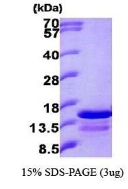 Novus Biologicals Recombinant Human Ghrelin/Obestatin His Protein 0.1mg; Unlabeled | Buy Online | Novus Biologicals&trade; | Fisher Scientific