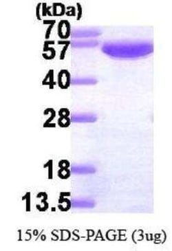 Novus Biologicals Recombinant Human Glucose 6 phosphate isomerase His Protein 0.1 mg | Buy Online | Novus Biologicals&trade; | Fisher Scientific