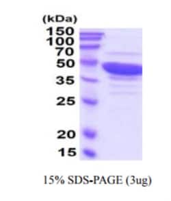 Novus Biologicals Recombinant Human Guanine deaminase Protein 5 &mu;g | Buy Online | Novus Biologicals&trade; | Fisher Scientific