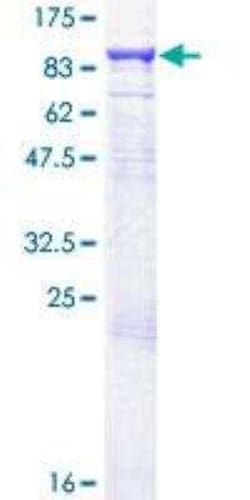 Novus Biologicals Recombinant Human Guanylyl Cyclase alpha 1 GST (N-Term) Protein 10 &mu;g | Buy Online | Novus Biologicals&trade; | Fisher Scientific