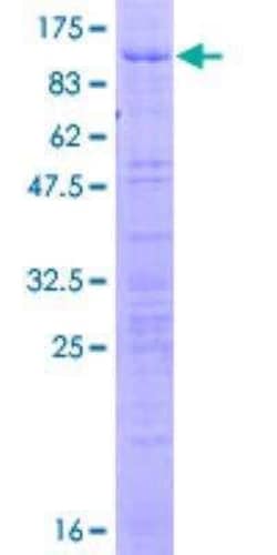 Novus Biologicals Recombinant Human HCC1 GST (N-Term) Protein 10 &mu;g | Buy Online | Novus Biologicals&trade; | Fisher Scientific