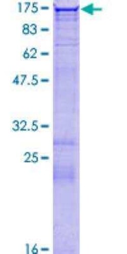 Novus Biologicals Recombinant Human HDAC9 GST (N-Term) Protein 2 &mu;g | Buy Online | Novus Biologicals&trade; | Fisher Scientific