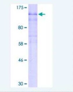 Novus Biologicals Recombinant Human HIF-2 alpha/EPAS1 GST (N-Term) Protein 2 &mu;g | Buy Online | Novus Biologicals&trade; | Fisher Scientific
