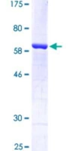 Novus Biologicals Recombinant Human HIF-2 alpha/EPAS1 GST (N-Term) Protein 10 &mu;g | Buy Online | Novus Biologicals&trade; | Fisher Scientific