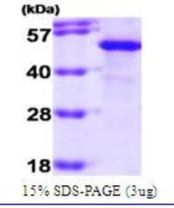 Novus Biologicals&trade;&nbsp;Recombinant Human Hsp70 interacting protein HIP Protein
