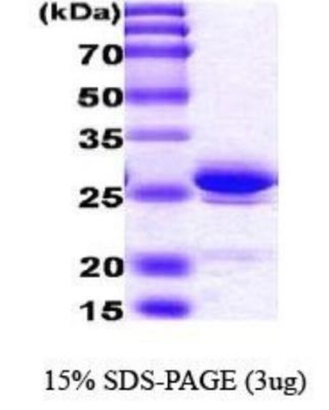 Novus Human HMGB1/HMG1 His Protein 0.1mgBiochemical Fisher Scientific