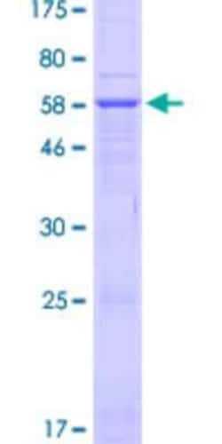Novus Biologicals Recombinant Human HSD3B7 GST (N-Term) Protein 10 &mu;g | Buy Online | Novus Biologicals&trade; | Fisher Scientific