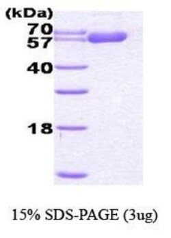 Novus Biologicals&trade;&nbsp;Recombinant Human HSP60 His Protein