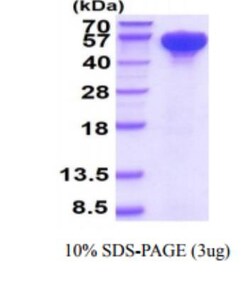 Novus Biologicals&trade;&nbsp;Recombinant Human HSP70/HSPA1A His Protein