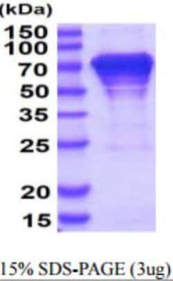 Novus Biologicals&trade;&nbsp;Recombinant Human HSPA8/HSC71/Hsc70 His Protein
