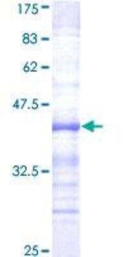 Novus Biologicals Recombinant Human HUNK GST (N-Term) Protein 25 &mu;g | Buy Online | Novus Biologicals&trade; | Fisher Scientific