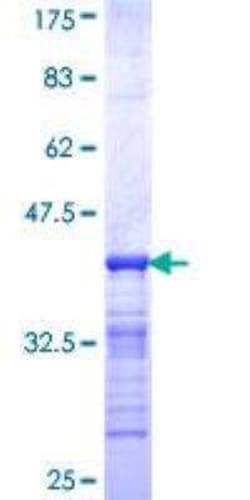 Novus Biologicals Recombinant Human Helios GST (N-Term) Protein 10 &mu;g | Buy Online | Novus Biologicals&trade; | Fisher Scientific