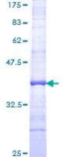 Novus Biologicals Recombinant Human Hemoglobin A1 GST (N-Term) Protein 25 &mu;g | Buy Online | Novus Biologicals&trade; | Fisher Scientific