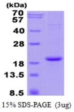 Novus Biologicals&trade;&nbsp;Recombinant Human Hemoglobin A2 His Protein