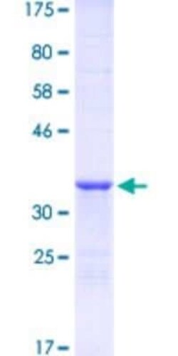 Novus Biologicals Recombinant Human Hey L GST (N-Term) Protein 10 &mu;g | Buy Online | Novus Biologicals&trade; | Fisher Scientific