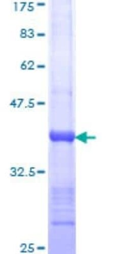 Novus Biologicals Recombinant Human Huntingtin GST (N-Term) Protein 10 &mu;g | Buy Online | Novus Biologicals&trade; | Fisher Scientific