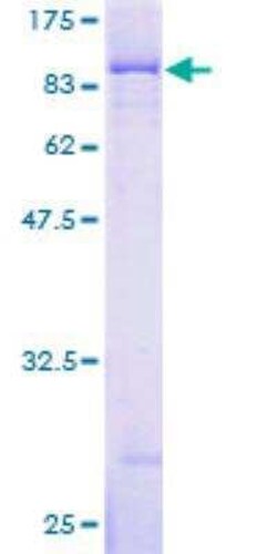 Novus Biologicals Recombinant Human IGF2BP3 GST (N-Term) Protein 2 &mu;g | Buy Online | Novus Biologicals&trade; | Fisher Scientific
