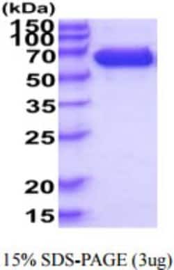 Novus Biologicals Recombinant Human IGSF8/CD316 His Protein 50 &mu;g | Buy Online | Novus Biologicals&trade; | Fisher Scientific