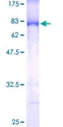 Novus Biologicals Recombinant Human IKK gamma GST (N-Term) Protein 25 &mu;g | Buy Online | Novus Biologicals&trade; | Fisher Scientific