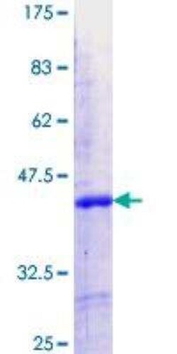 Novus Biologicals Recombinant Human IKZF5 GST (N-Term) Protein 10 &mu;g | Buy Online | Novus Biologicals&trade; | Fisher Scientific