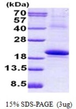 Novus Biologicals&trade;&nbsp;Recombinant Human IL-18 BPa/IL18BP His Protein