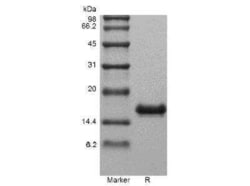 Novus Biologicals Recombinant Human IL-31 Protein 100 &mu;g | Buy Online | Novus Biologicals&trade; | Fisher Scientific