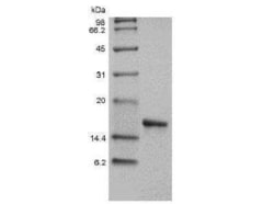 Novus Biologicals Recombinant Human IL-36 alpha/IL-1F6 Protein 1 mg | Buy Online | Novus Biologicals&trade; | Fisher Scientific
