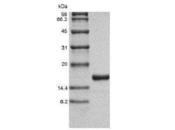 Novus Biologicals Recombinant Human IL-36 gamma/IL-1F9 Protein 1 mg | Buy Online | Novus Biologicals&trade; | Fisher Scientific