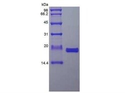 Novus Biologicals Recombinant Human IL-36 gamma/IL-1F9 Protein 500 &mu;g | Buy Online | Novus Biologicals&trade; | Fisher Scientific