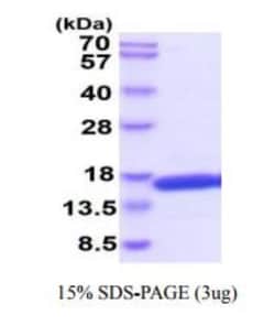 Novus Biologicals&trade;&nbsp;Recombinant Human IL-4 His Protein