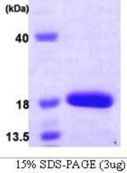 Novus Biologicals Recombinant Human SF20/MYDGF His Protein 0.1mg; Unlabeled | Buy Online | Novus Biologicals&trade; | Fisher Scientific