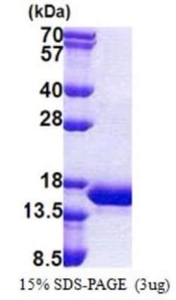 Novus Biologicals&trade;&nbsp;Recombinant Human INCA His Protein