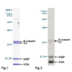Novus Biologicals Recombinant Human IRAK4 GST (N-Term) Protein 25 &mu;g | Buy Online | Novus Biologicals&trade; | Fisher Scientific