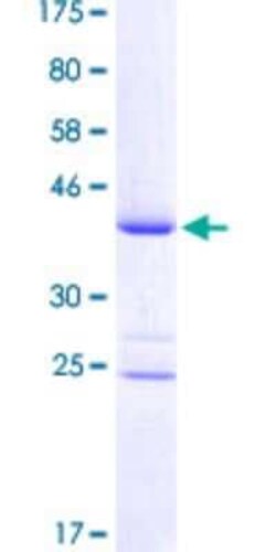 Novus Biologicals Recombinant Human IRX6 GST (N-Term) Protein 25 &mu;g | Buy Online | Novus Biologicals&trade; | Fisher Scientific