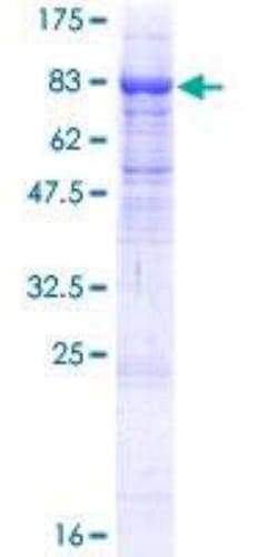 Novus Biologicals Recombinant Human ITFG1 GST (N-Term) Protein 10 &mu;g | Buy Online | Novus Biologicals&trade; | Fisher Scientific