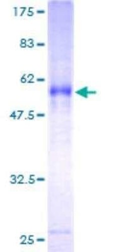 Novus Biologicals Recombinant Human ITM2A GST (N-Term) Protein 25 &mu;g | Buy Online | Novus Biologicals&trade; | Fisher Scientific
