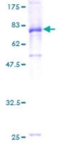 Novus Biologicals Recombinant Human IgA1 GST (N-Term) Protein 25 &mu;g | Buy Online | Novus Biologicals&trade; | Fisher Scientific